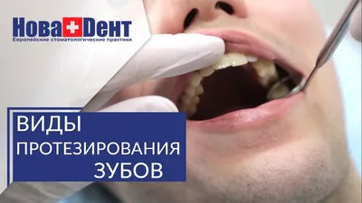 Полная имплантация зубов - Имплантация при полном отсутствии зубов, цены |  НоваДент | НоваДент