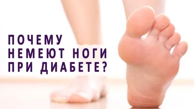 Из-за чего немеют ноги при сахарном диабете? - YouTube