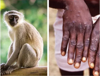 Оспа обезьян: откуда она пришла и что от нее ждать — Naked Science