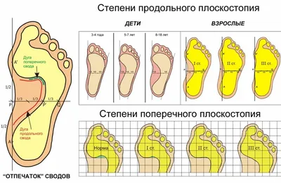 Обувь от плоскостопия — купить по низкой цене на Яндекс Маркете