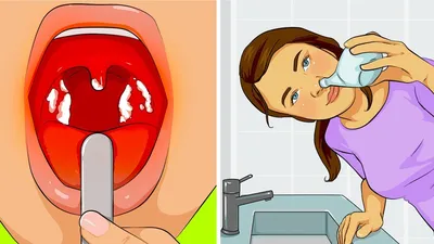 10 Способов Убить Зубную Боль за Минуту - YouTube