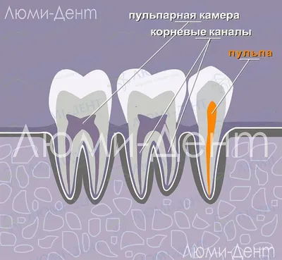 Зубной Нерв [Как Успокоить] 3 Способа Болит Зуб Дома Фото Как Обезболить  Уксусом Йодом ЛюмиДент