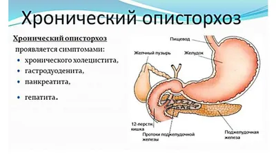 Как лечить описторхоз у взрослых