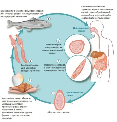 Лечение и диагностика описторхоза в Красноярске | Первый Меридиан