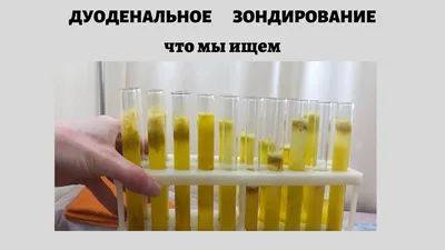 описторхоз #аллергия #астма #диагностика Анализ желчи. - YouTube