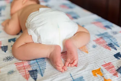 Как лечить опрелости у новорожденных
