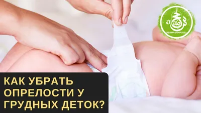 КАК УБРАТЬ ОПРЕЛОСТИ У ГРУДНЫХ ДЕТОК? | ХИДЖАМА СУННА