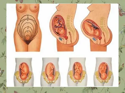 Как понять, что опустился живот и за сколько до родов он опускается при 1 и  2 беременности, что делать, если это произошло, отзывы