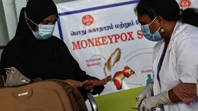 Оспа обезьян 2022: симптомы, как передается вирус, случаи заражения и  лечение
