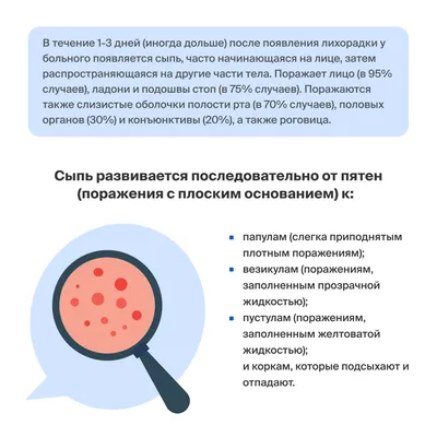 Вирус обезьяньей оспы: симптомы и профилактика | doc.ua