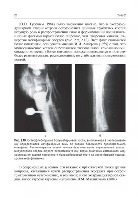 Иллюстрация 9 из 9 для Гематогенный остеомиелит у детей - Разин, Стрелков |  Лабиринт - книги. Источник: Лабиринт