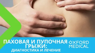Удаление грыжи (паховой, пупочной) в Киеве – клиника Оксфорд Медикал