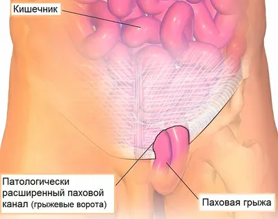 Целясь в живот | Пикабу