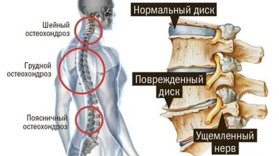 Мышцы позвоночника ☯ Движения позвоночника обеспечиваются его мышцами. Мышцы  позвоночника можно.. | ВКонтакте