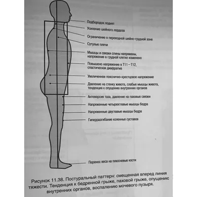 Tuberculosis of the spine: radiodiagnosis - Tsybulskaia - Consilium Medicum