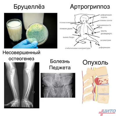 Paleoneo - лаборатория функциональной неврологии