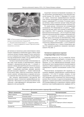 Проведение паравертебральной блокады в Минске