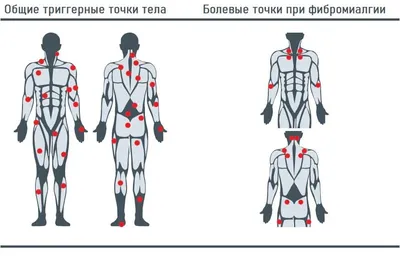 Презентация \"Антигравитационная мускулатура\" – скачать проект