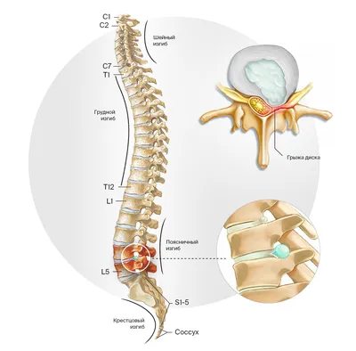 Лечение протрузии грудного отдела позвоночника в Екатеринбурге - Новая  больница