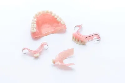 Пародонтоз и протезирование зубов: совместимы или нет?