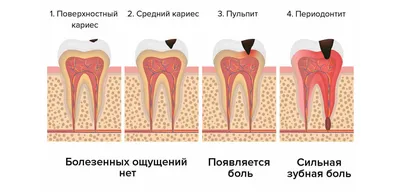Лечение периодонтита в Москве, цены в стоматологии Самсон-Дента