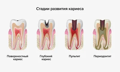 Особенности диагностики различных форм периодонтита | Москва