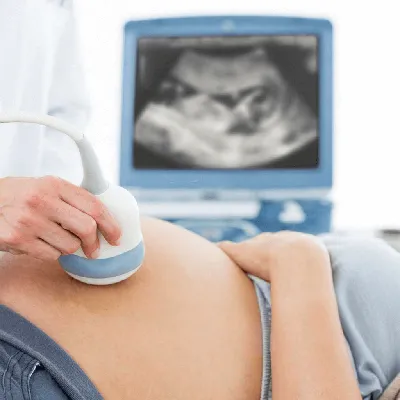 УЗИ при беременности в Балашихе | Cделать узи по беременности: 1 скрининг  цена