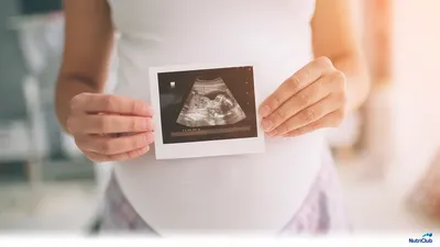 Второй скрининг тест при беременности | Nutriclub