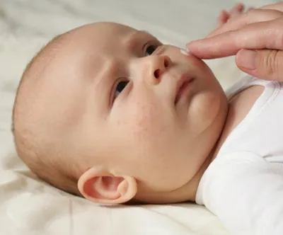 Аллергия у новорожденных: причины, проявление и лечение. - Телеграф