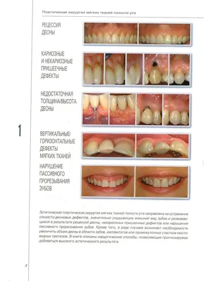 Книга Пластическая хирургия мягких тканей полости рта - купить  здравоохранения, медицины в интернет-магазинах, цены на Мегамаркет |  978-5-91443-046-4