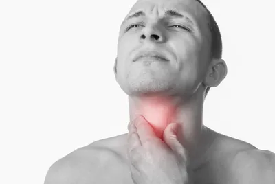 Рак горла: симптомы, фото на ранних стадиях