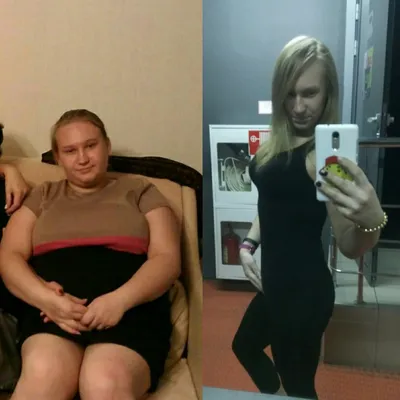 Подросток разъелся до 132 кг в 16 лет: история похудения на 42 кг