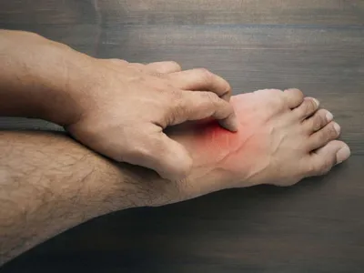 Сыпь на ногах: возможные причины и терапия у взрослых и детей