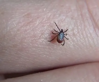 Сезон клещей: как уберечь себя от укусов насекомых (Видео) - Телеграф