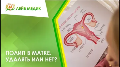 😟 Полип в матке. Удалять или нет? - YouTube