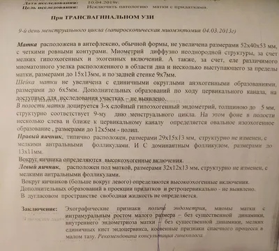 Гормональные препараты Solvay Pharma Дюфастон - «Я избавилась от полипа в  матке за 10 дней Дюфастона! Можно ли догадаться, что у вас есть полип?  Какие побочные эффекты я ощутила на себе, и