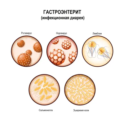 Диарея - причины появления, при каких заболеваниях возникает, диагностика и  способы лечения