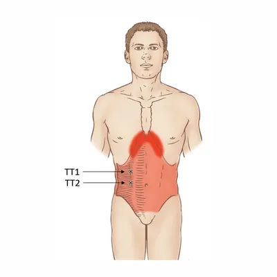 Поперечная мышца живота: анатомия, триггерные точки, клиническая значимость