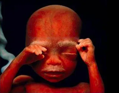 Потрясающие фото развития малышей в утробе матери - onedio.ru