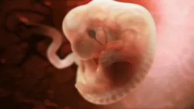 10 невероятных фото о том, как развивается плод в утробе матери