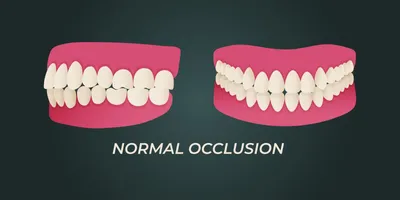 Как выглядит правильный прикус зубов и как его определить