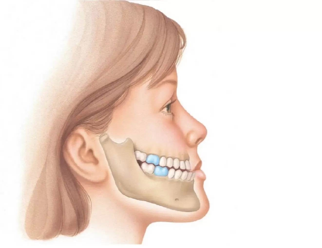 Зубы при закрытом рте. Микрогнатия недоразвитие нижней челюсти. Микрогнатия верхней челюсти. Дистальный прикус (прогнатический прикус). Мезиальный прикус Энгля.
