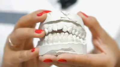 Правильный прикус у человека: фото зубов |