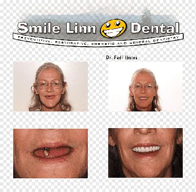 Smile Linn Dental: стоматология Ibsies Fadi B DMD Лейк Освего Рот, улыбка  стоматологическая, лицо, другие, стоматология png | PNGWing