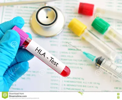 Гепатит: виды инфекции и где николаевцам можно от него вакцинироваться, -  ФОТО | Новини