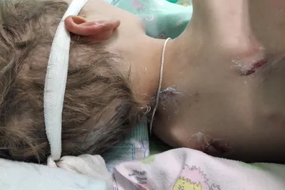 7-летнего ребенка в Канске Красноярского края госпитализировали с кишечной  инфекцией, через несколько дней он впал в кому 10 ноября 2022 г - 10 ноября  2022 - НГС24