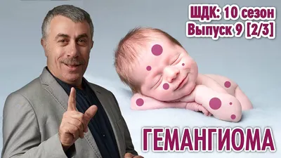 Гемангиома - Доктор Комаровский - YouTube