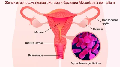 Микоплазмоз у женщин и мужчин: лечение, симптомы, причины