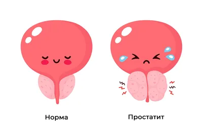 Острый простатит - Медицинский центр Семья | Липецк