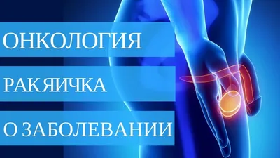 Орхифуникулэктомия в Ужгороде: Операция по удалению яичек при раке у мужчин